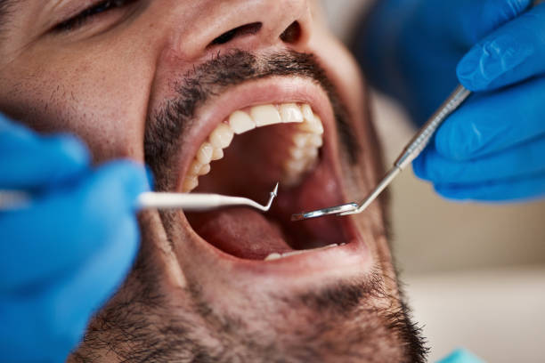 Best Root Canal Emergency Dentist  in Prudenville, MI